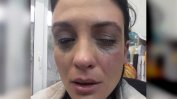 Прокуратурата не откри доказателства за побой срещу актрисата Диана Димитрова